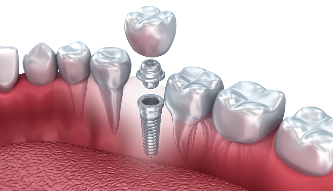 Dentistry Near me