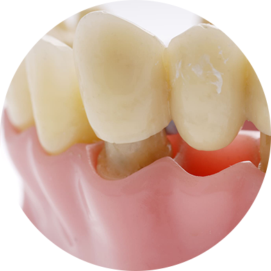 Best Dental Clinic in Vadapalani, Chennai